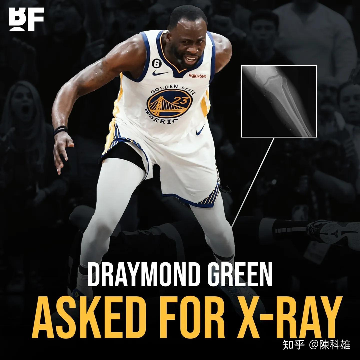 包含今晨体能课后,萨克拉门托国王绝杀压哨备战意甲,更衣室稳定,细节决定成败的词条 包含今晨体能课后,萨克拉门托国王绝杀压哨备战意甲,更衣室稳定,细节决定成败的词条